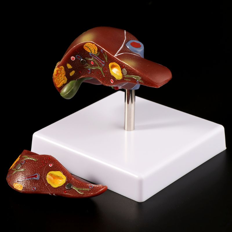 Medical Lab Assistant - Modelo anatômico de fígado humano, equipamento